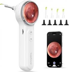 ScopeAround Otoscope with Light, Digital Otoscope w/1.85in IPS Screen, 720p HD Ear Wax Removal Tool Camera, Video Otoscope Ear Camera with 6 LED Lights, Compatible with Android/iPhone