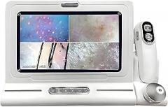 Scalp Analysis Machine with 11-Inch LCD & with 50x & 200x Pair Handle Probe for Scalp Treatments & Client Consultations at Salons and Home