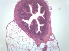 EISCO Fallopian Tube, Cross Section - Prepared Microscope Slide - 75 x 25mm - Biology & Microscopy