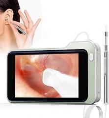 Ear Wax Removal Otoscope,Sinohrd Ear Camera with 5 Inch 1080P HD Screen Ear Scope Otoscopes,3.9mm Light Lens Inspection Endoscope Ear Wax Removal Tool USB Rechargeable Otoscope