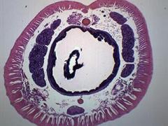 EISCO Earthworm Setae, Cross Section - Prepared Microscope Slide - 75 x 25mm - Biology & Microscopy