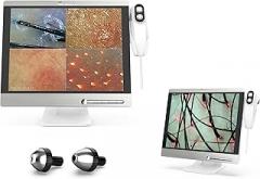 15.5-inch Scalp Camera, high-Resolution Hair and Scalp Analysis Device, 50/200x Lens, 32G Image Storage, Suitable for Customer Consultation and Head spa