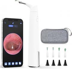 Otoscope with Light, WiFi Ear Camera with Dual View, 720p HD Ear Scope with 6 LED Lights, 3.9mm Lens Ear Cleaner Camera for Kids & Adults, Compatible with iPhone & Android